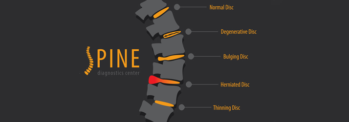 Chiropractic Katy TX Back Pain Disc Illustration