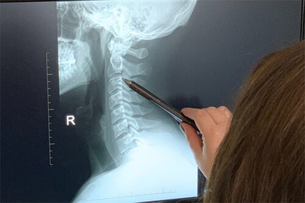 Chiropractic Katy TX Reading X-ray