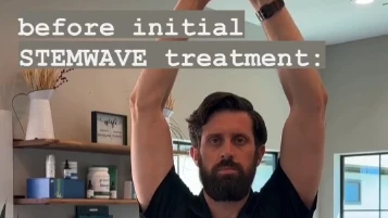 Chiropractic Katy TX Stemwave Video Thumbnail